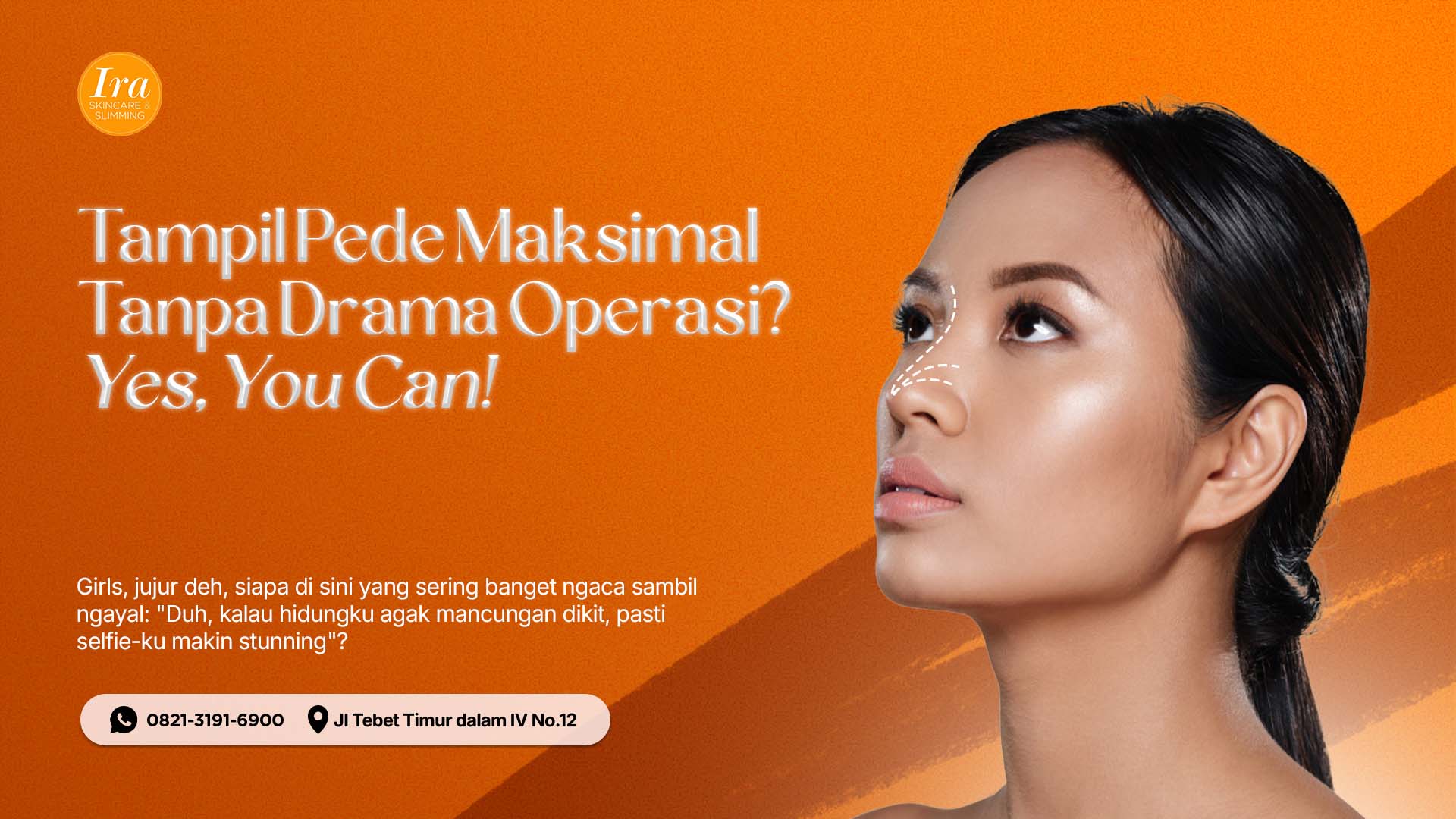 Threadlift Thumbnail Artikel 2