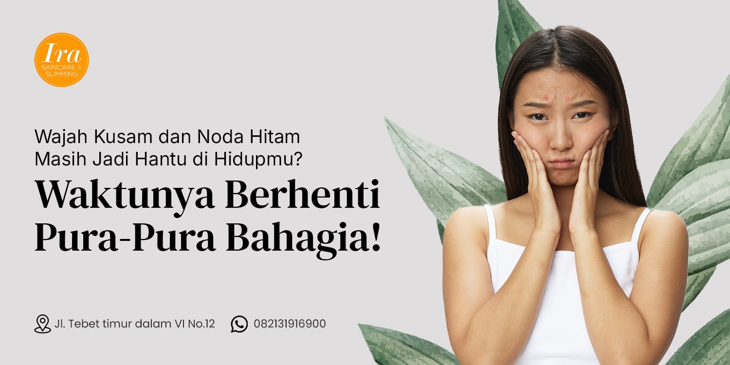 Thumbnail Wajah Kusam dan Noda Hitam Masih Jadi Hantu di Hidupmu